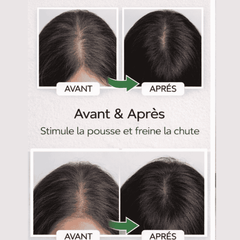 Résultat avant et après utilisation de Minofy Lotion Anti-Chute pour stimuler la pousse des cheveux