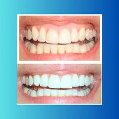 crest 3d white dentifrice 147g Makushop