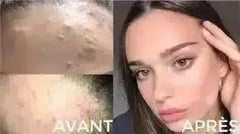 Cerave Créme Lavante Hydratante Peaux Normales à Sèches - Makushop