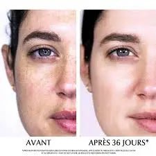 Eucerin Anti-Pigment avec Thiamidol pour l'apparence des taches et de l'hyperpigmentation