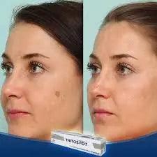 Eva Pharma Tritospot crème anti tâches brunes - 15g - Makushop