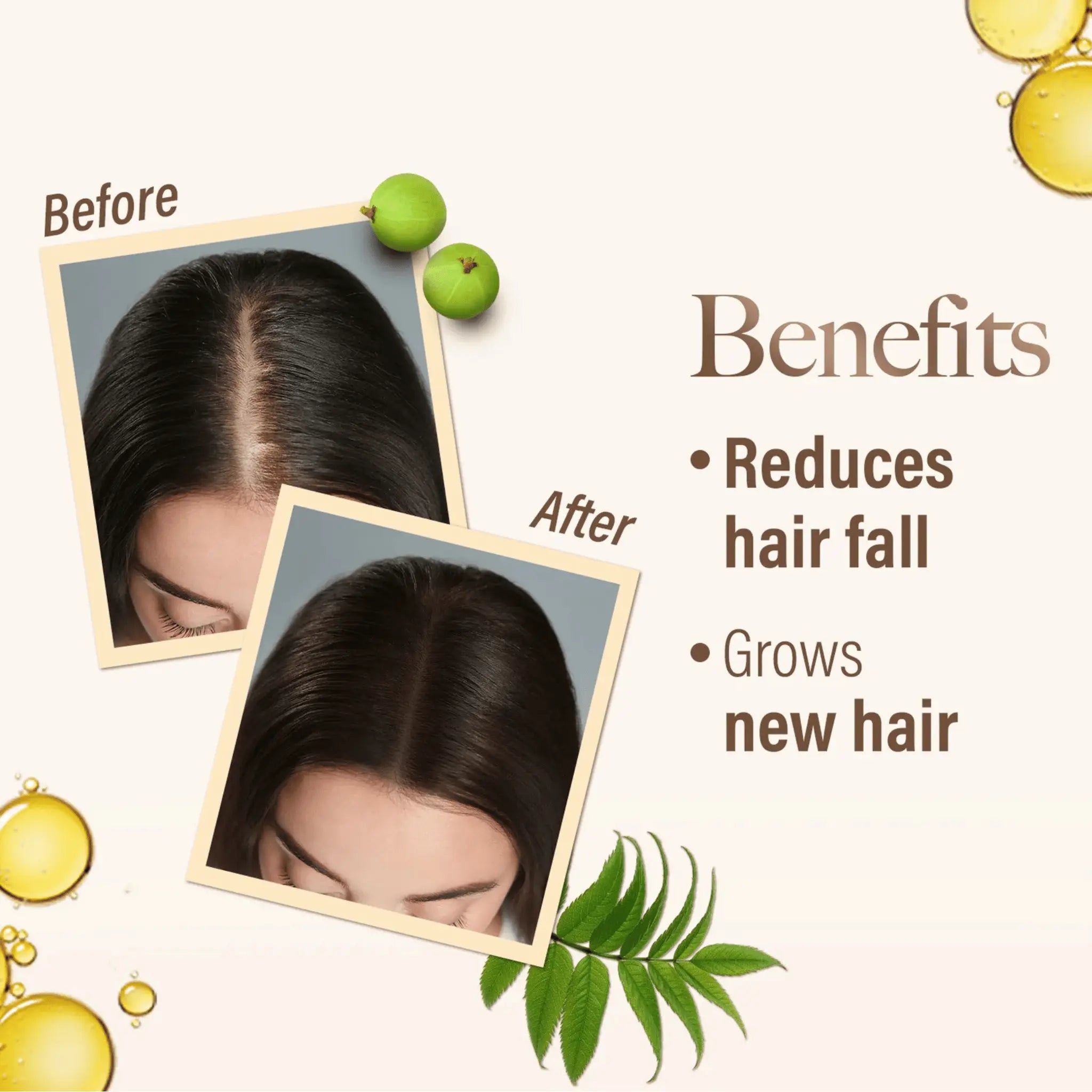 Kesh King oil Ayurvedic scalp and hair medicine kesh king