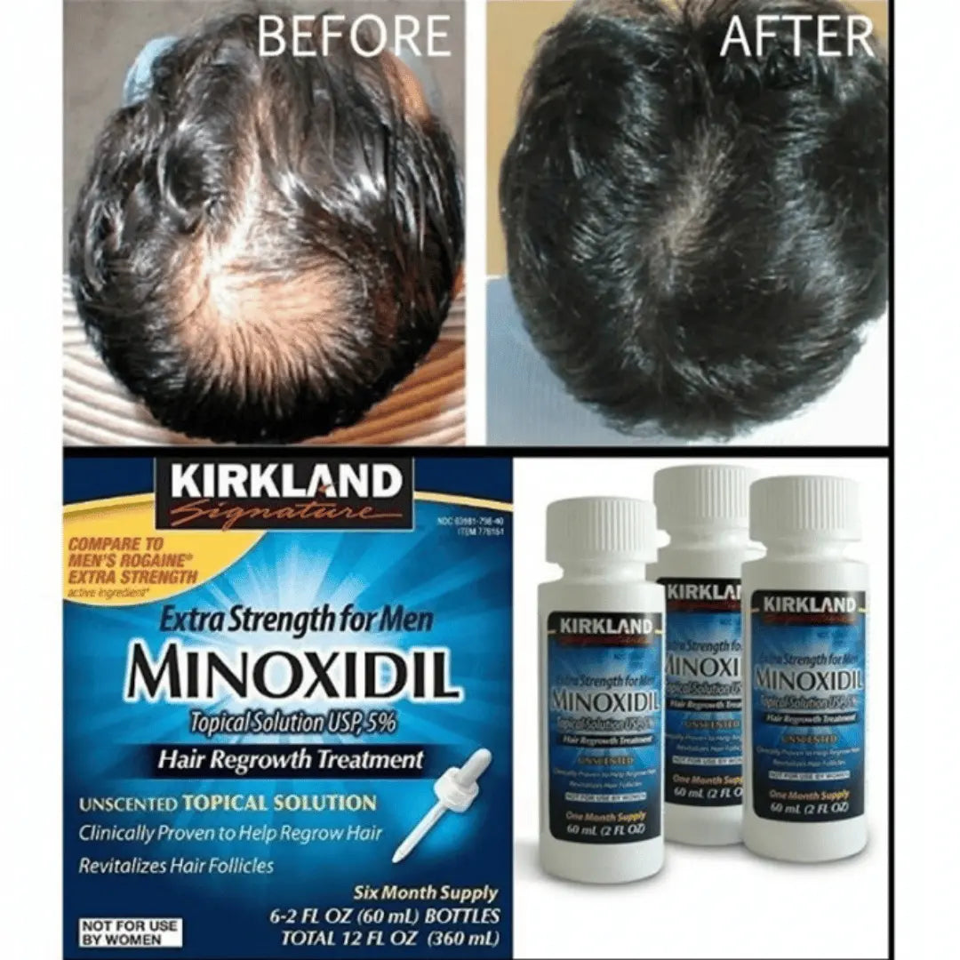 Kirkland Minoxidil Strength Regrowth economy - Makushop