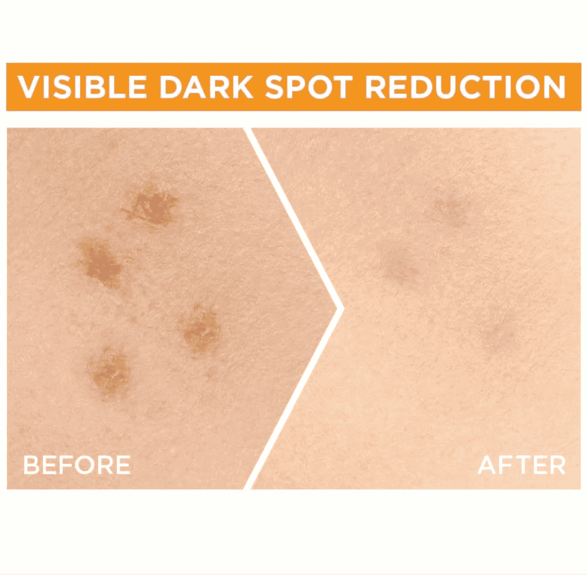 Garnier Fast Bright sérum vitamine C x30 anti-taches éclaircissant visage