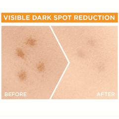 Garnier Fast Bright sérum vitamine C x30 anti-taches éclaircissant visage